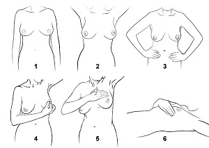 Breast Self-Examination