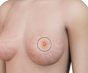 Breast Nipple Changes
